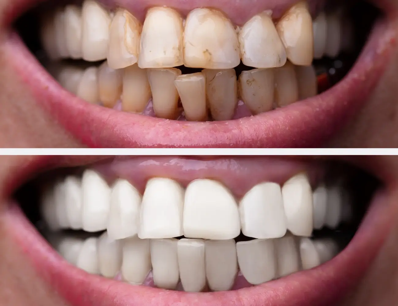 Comprehensive Smile Rejuvenation - Before and After clinical results at Specialist Dental Clinic Guntur
